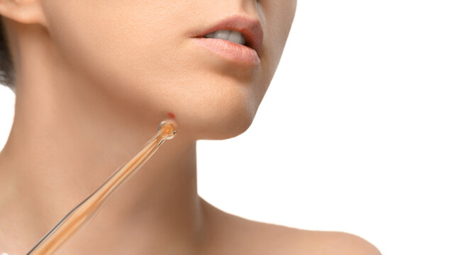 The girl uses the darsonval device to treat problem areas of the skin on her face. Face care at home, close-up white isolated background.