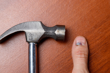 Man hit his thumb with a hammer