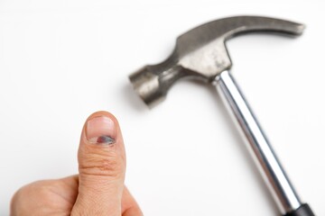 Man hit his finger with a hammer