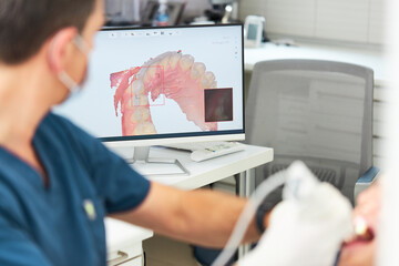 The dentist scans the patient's teeth with a 3d scanner. - 388383172