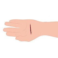 injured hand with bleeding gash with wound on the hand palm vector illustration