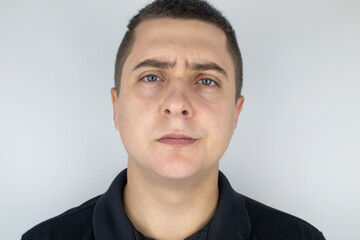 Fototapeta premium A man stands in front of a mirror and sees inflammation of the upper eyelid. Redness of the skin around the eyes and blepharitis.