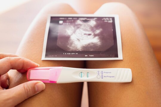 A woman holding a pregnancy test and a photo of the baby. Planning to be a mother.