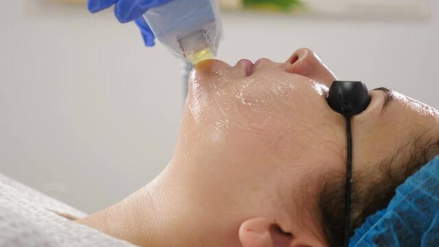 Nonsurgical facelift in beauty salon. machine cosmetology. Facelift device makes flashes. Faceskin renovation. Close-up shot of woman in protective glasses getting beauty procedure. 4 k