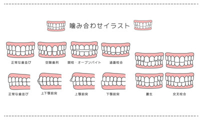 歯科_歯科矯正・歯並び・噛み合わせ一覧 