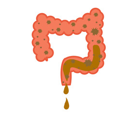 Sick intestines on a white background. Diarrhea. Infection. Vector illustration.