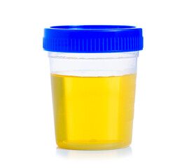 container for urine analysis on white background isolation