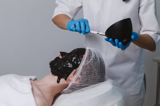 Doctor preparing alginate mask.