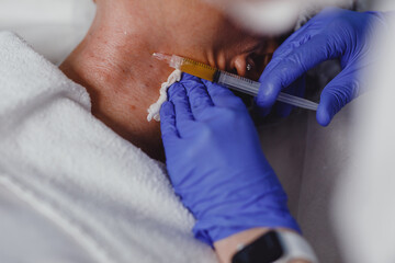 Process of injectable cosmetology