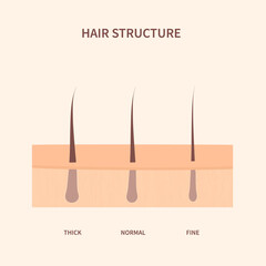 Hair thickness types classification set. Skin cross-section with fine, normal, thick strands. Anatomical structure scheme. Cartoon vector illustration. 