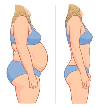 Woman's body before and after weight loss. Vector illustration.