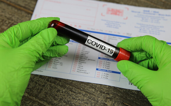 Viersen, Germany - March 22. 2020: Close up of isolated hands with green gloves holding blood sample vial with word covid-19. Blurred lab test request form background.