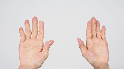 Senior or older woman hand that had arthritis or trigger fingers on white background.