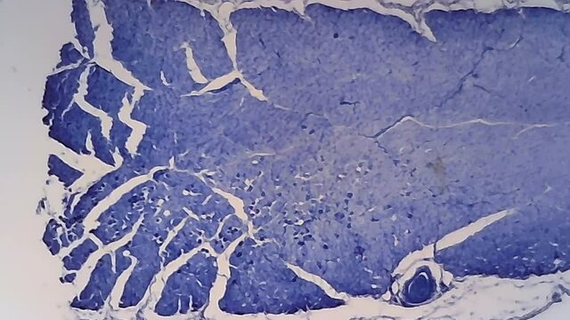 Microscope Human Skeletal Muscle 1200x 1
