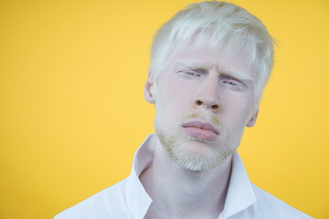 albinism albino man in studio dressed t-shirt isolated on a yellow background. abnormal deviations....