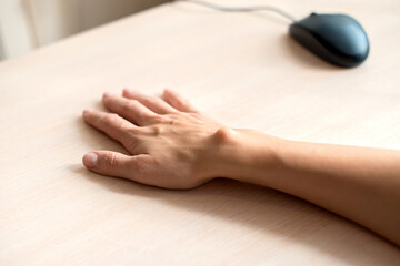 Female hand with a hygroma. Pain. Wrist ganglion cyst. Computer mouse