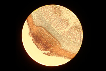 Real photo of plant cells lentil under the microscope