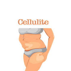 Vector isolate flat design of woman body with cellulite on belly and thigh. Cartoon of fat woman wearing sportswear and standing,right hand on the abdomen The left hand holds the thigh.