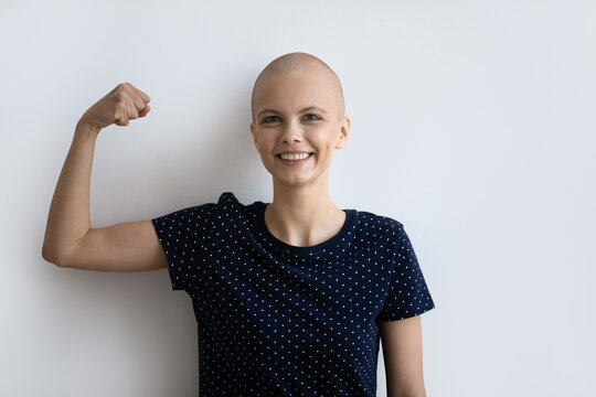 Close up smiling hairless woman showing strength, power, standing on white background, struggling with cancer, happy bald female patient feeling optimistic, healthcare and treatment concept