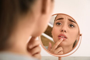 Emotional woman with herpes touching lips in front of mirror against light background - obrazy, fototapety, plakaty