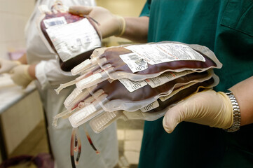 scientist's hand holds a red blood bag in the laboratory of a blood Bank unit.The doctor selects...