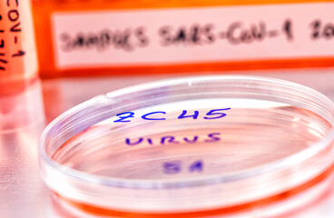 bat coronavirus ZC45 on petri dish, COVID-19 study in laboratory, conceptual image