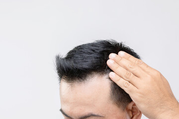 Fototapeta premium Portrait Asian man with worry feeling and touching on his head to show bald head or Glabrous problem. Studio shoot with copy space with grey