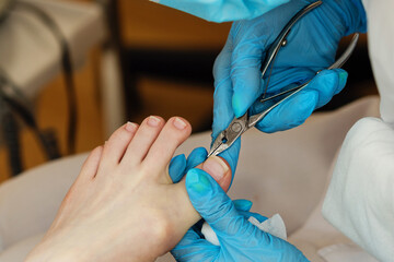 Master chiropody removes the cuticle. Cuticle treatment is one of the stages of processing the...
