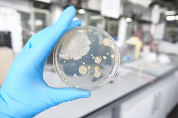 Scientist hands holding a petri dish with bacterial colonies. Laboratory routine work concept.