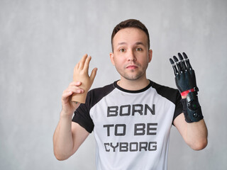 man with bionic Prosthetic Arm