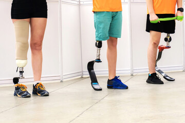 People with amputated limbs lead an active lifestyle. Running prostheses for sports. Cropped frame. No face.