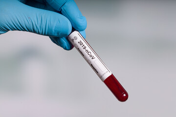 hand in blue gloves holding a coronavirus blood test tube in front of a lab room 