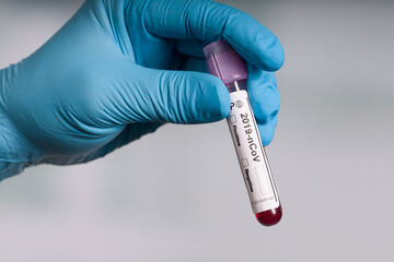 Obraz premium hand in blue gloves holding a coronavirus blood test tube in front of a lab room 