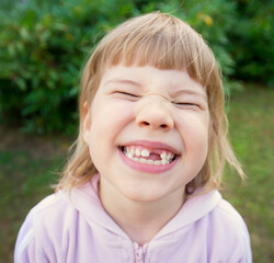 Cute young child make grimace with missing teeth