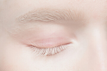 Brow and eyelid. Close up portrait of beautiful albino female model. Parts of face and body....