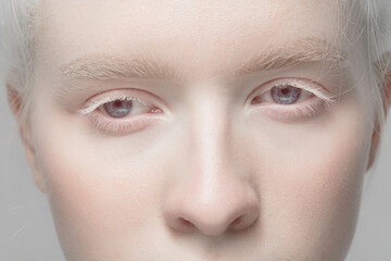 Nose and eyelid. Close up portrait of beautiful albino female model. Parts of face and body. Beauty, fashion, skincare, cosmetics, wellness concept. Copyspace. Well-kept skin, fresh look, details. - Powered by Adobe