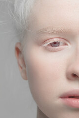 Eyes open. Close up portrait of beautiful albino female model. Parts of face and body. Beauty, fashion, skincare, cosmetics, wellness concept. Copyspace. Well-kept skin, fresh look, details. - obrazy, fototapety, plakaty