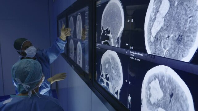 Neurologists studying brain scans