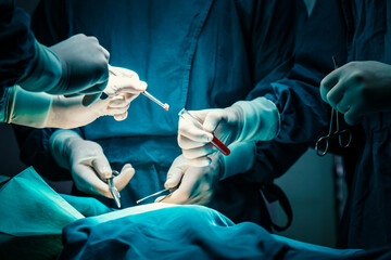 concentrated professional surgical doctor team operating surgery a patient in the operating room at hospital. tumor cancer. surgical biopsy specimens. healthcare and medical concept. - obrazy, fototapety, plakaty
