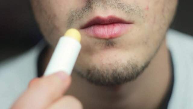 Young Caucasian man with dark hair with dry lips smears lips with male hygienic lip balm. Сlose-up.