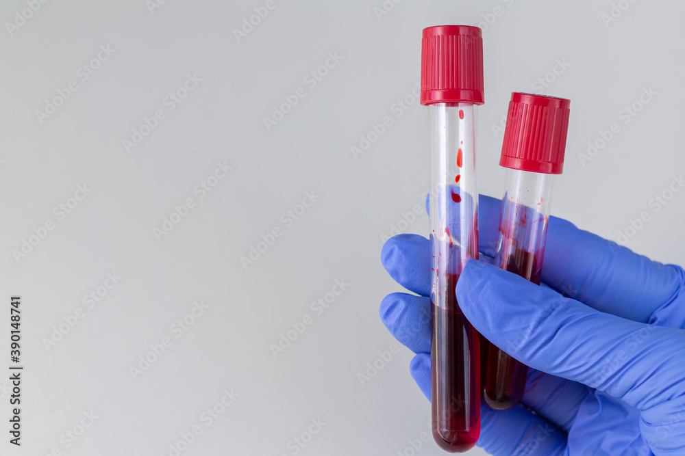 Wall mural doctor holding test tubes with blood ready for testing