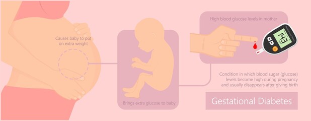 Gestational diabetes preeclampsia pre eclampsia depression