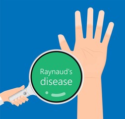 Raynaud's disease erythematosus Scleroderma buerger circulation paleness cold Injury numb vasospasm Carpal tunnel