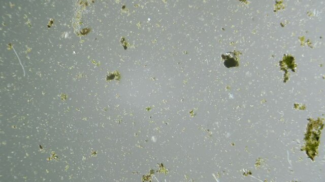 Unicellular organisms and algae  under microscope magnification freshwater sample