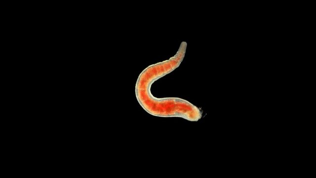 Oligochaeta worm under a microscope, type Annelida, sample found at Lake Baikal. Video may contain a part of the worm that moves and contracts
