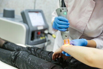 laser hair removal procedure by a beautician. epilation of hands with a laser device close-up. cosmetologist makes laser epilation in a cosmetology clinic