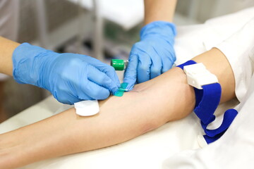 taking blood from a vein close-up. blood test in the hospital. the doctor's hands draw blood from a...