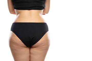 Back view. Overweight woman with fat cellulite legs and buttocks, obesity female body in black...