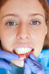 dentist clening tooth  in  mouth patient with toothpick. blue gloves. close up image.