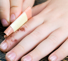 finger is already healing